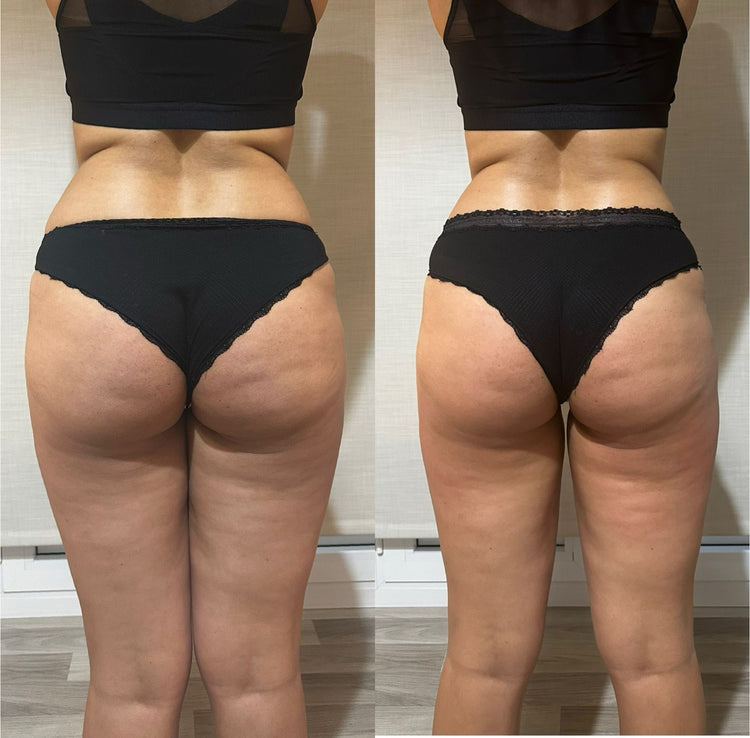 BONO PRIMAVERA | 2 Magic Redux + 1 Magic Push Up + 1 Magic ABS