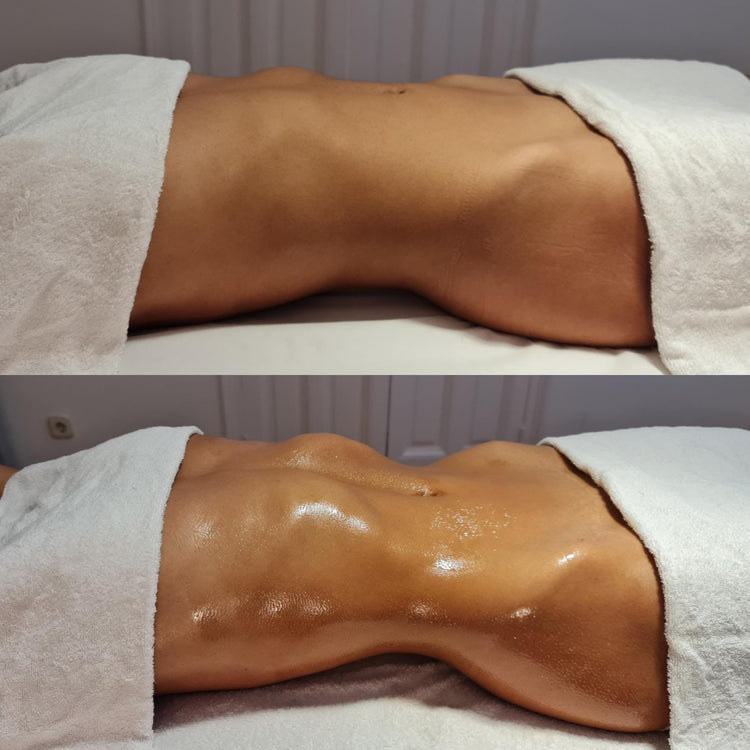 Magic Redux Mujer | Masaje reductor y drenante