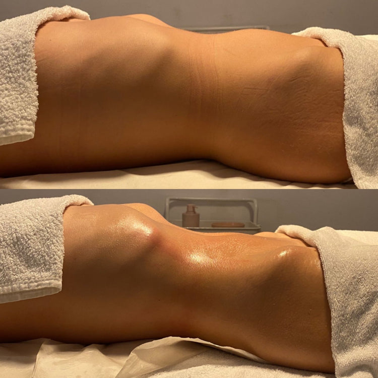 Magic Redux Mujer | Masaje reductor y drenante