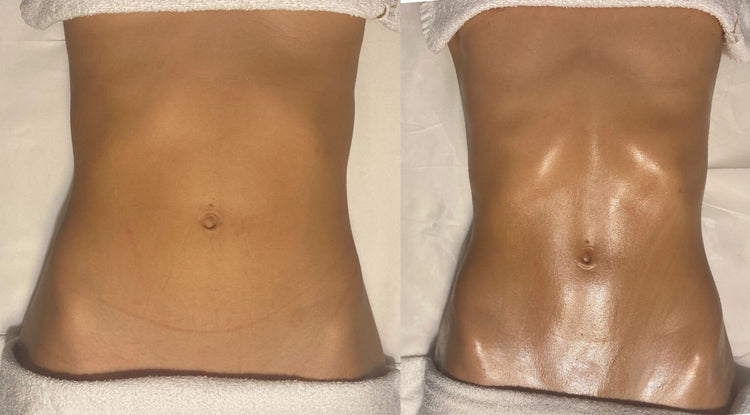 BONO PRIMAVERA | 2 Magic Redux + 1 Magic Push Up + 1 Magic ABS